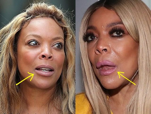 Wendy Williams