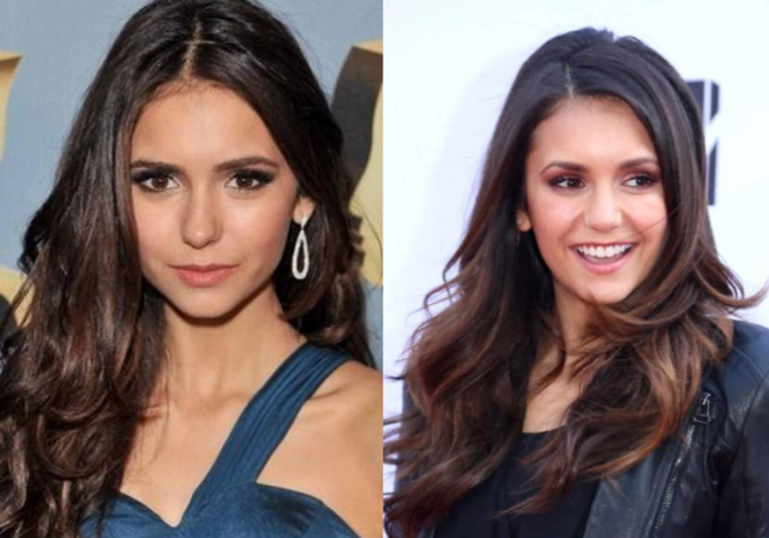 Nina Dobrev plastic surgery