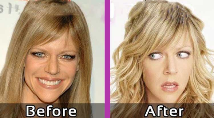 Kaitlin Olson plastic surgery