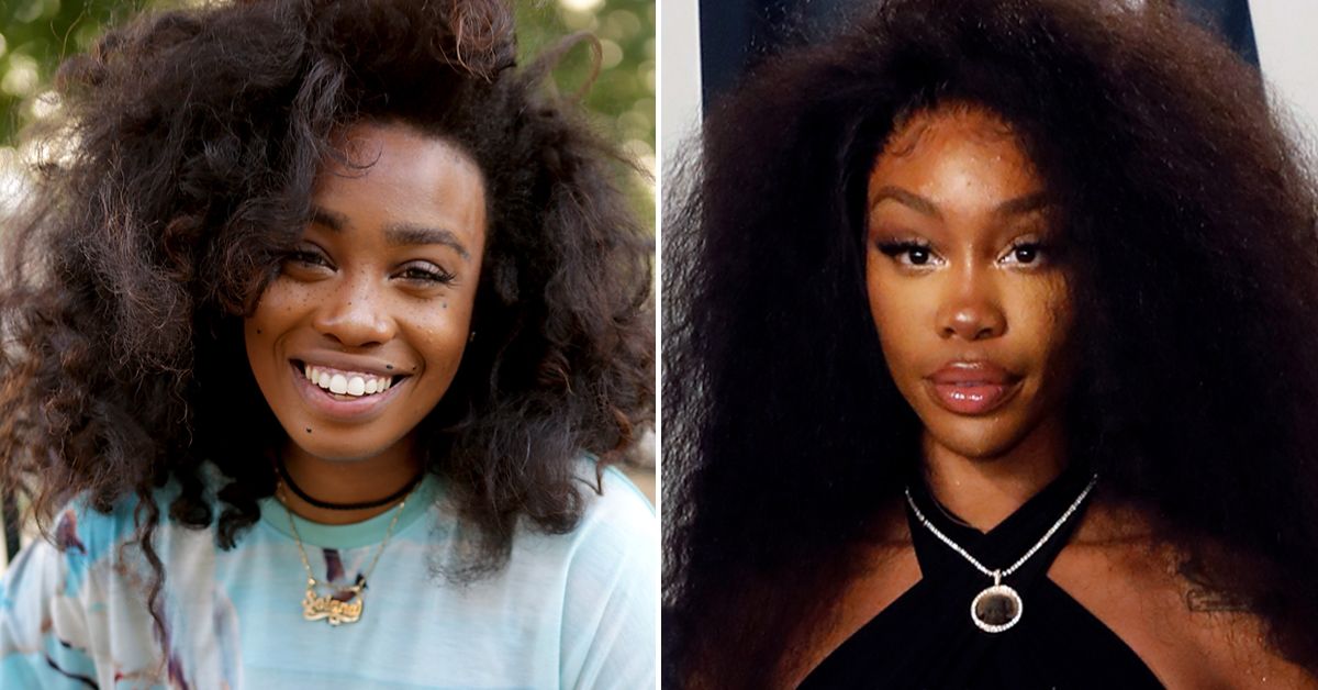 The Truth About SZA’s Plastic Surgery Rumors 