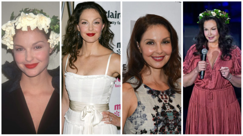What Happened to Ashley Judd’s Face, Plastic Surgery or Accident?
