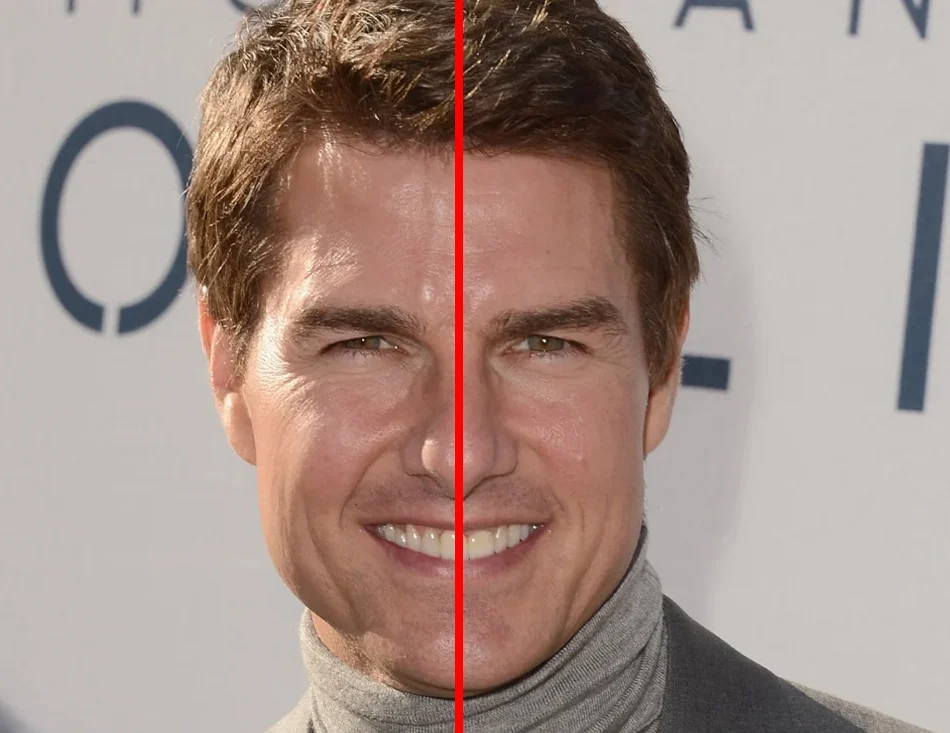 Tom Cruise Teeth: What Happened To His Middle Tooth and Does It Affect His Smile